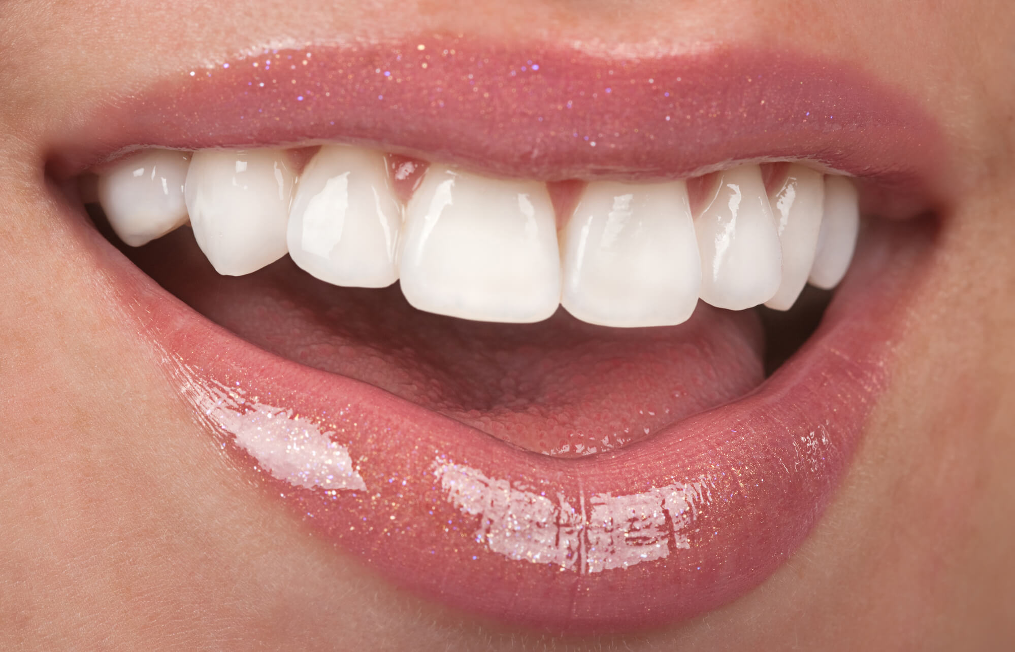 where is the best teeth whitening miami?