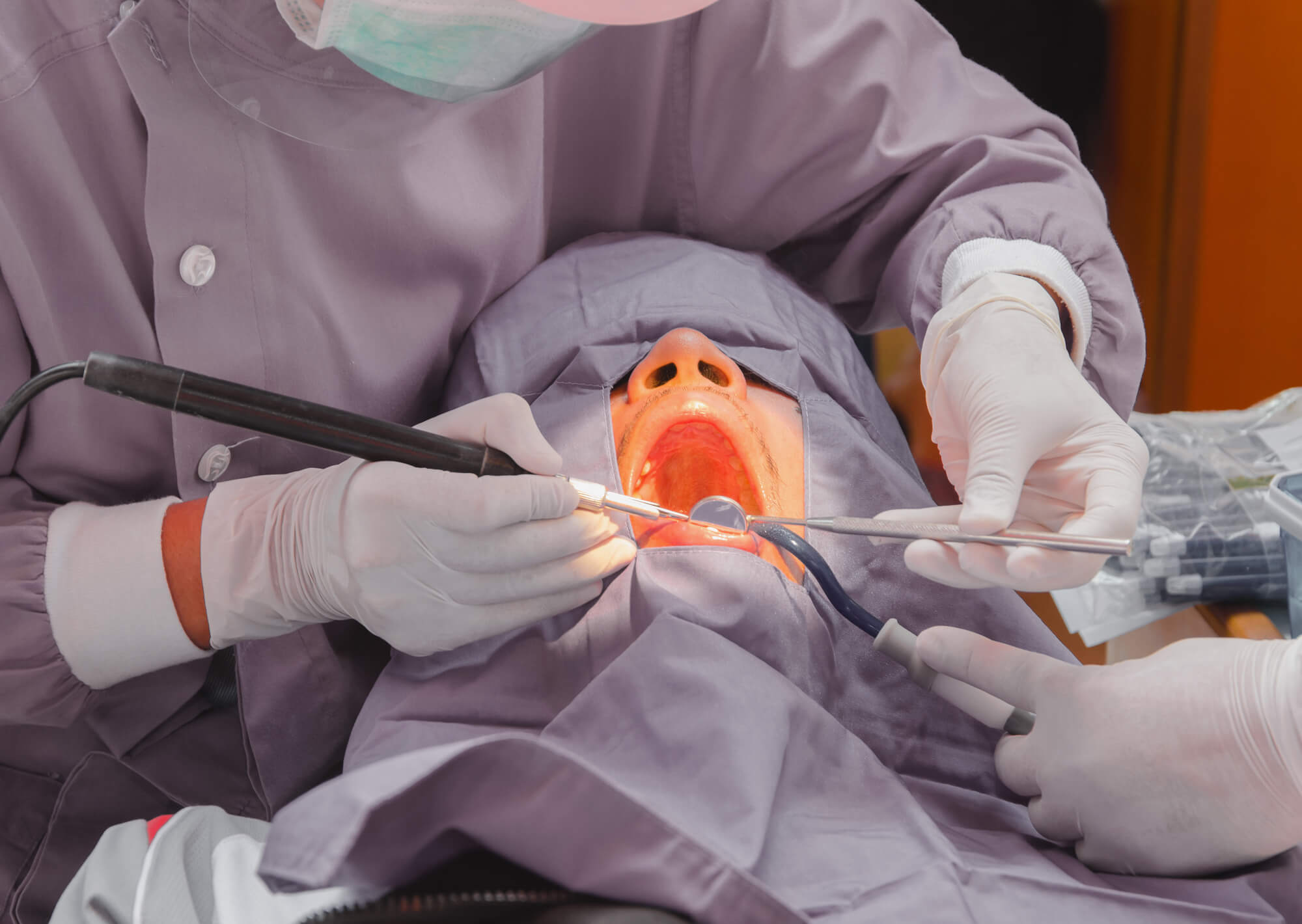 Dentist Miami Airport removing plaque from patient's teeth