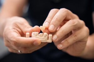 Hands hold a 3D-printed dental model and a single tooth crown, demonstrating a restoration process.